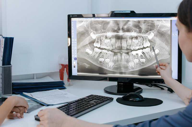 How 3D Technology is Transforming Dental Care
