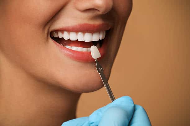 Replacing Old Veneers in Portland: What Patients Should Expect