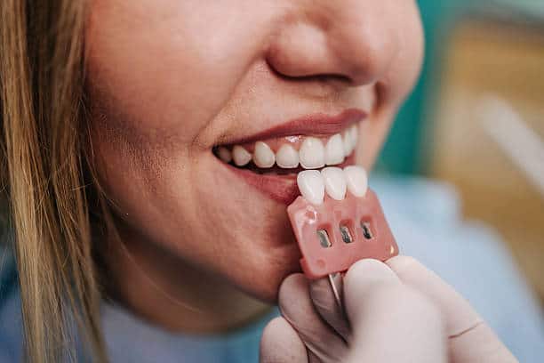 Dental Veneers vs. Crowns in Portland: Which Is the Right Choice?