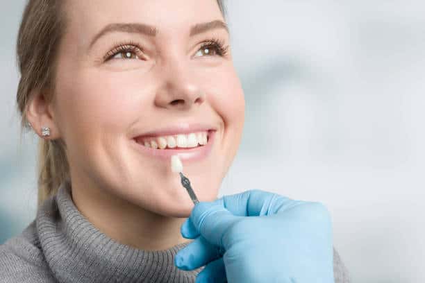 Getting Veneers in Portland: Recovery and Aftercare Guide