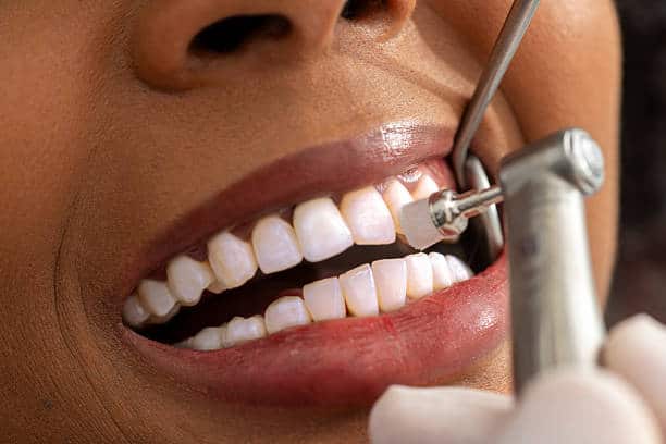 How Often Should You Get a Dental Cleaning in Portland?
